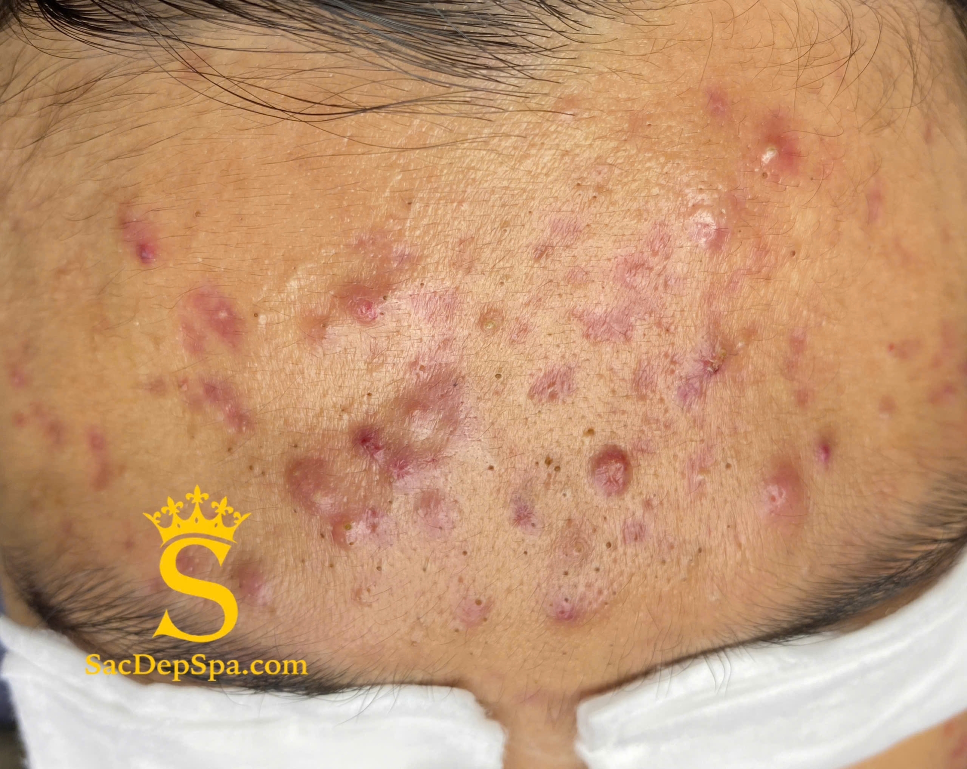 BẢNG GIÁ & GÓI DỊCH VỤ SẮC ĐẸP SPA — 2025 BẢNG GIÁ & GÓI DỊCH VỤ SẮC ĐẸP SPA — 2025